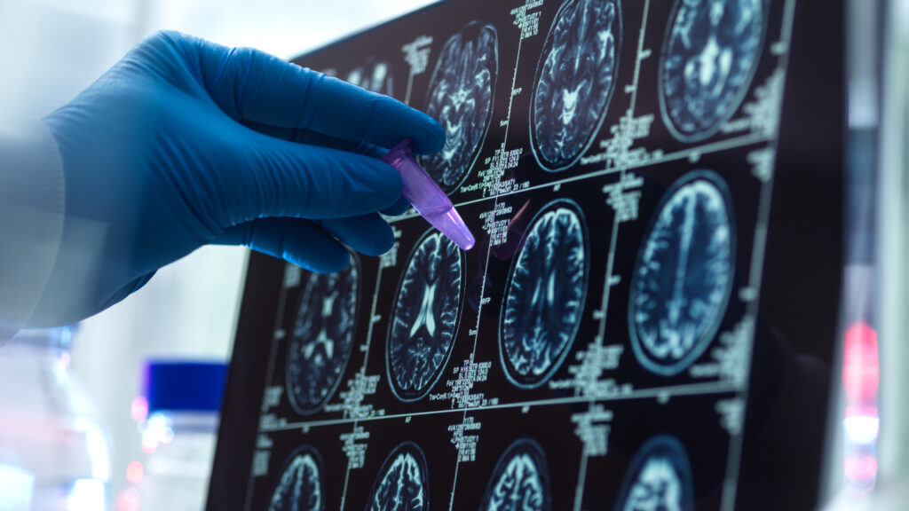 médico a examinar raio x e exames ao cérebro