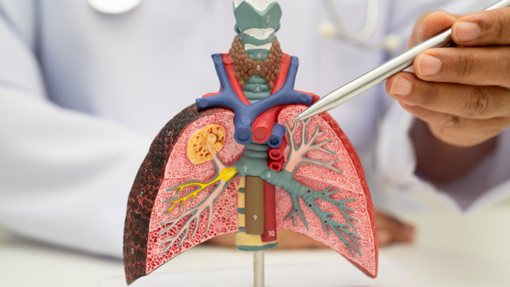 pulmão com doença pulmonar obstrutiva crónica